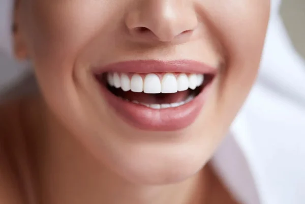 Procelain Veneers